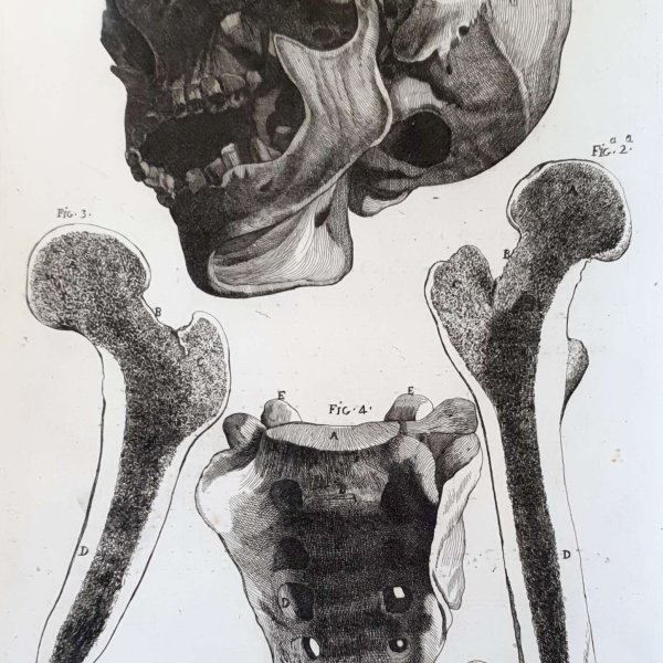 LAVALÉE Jean-Jacques